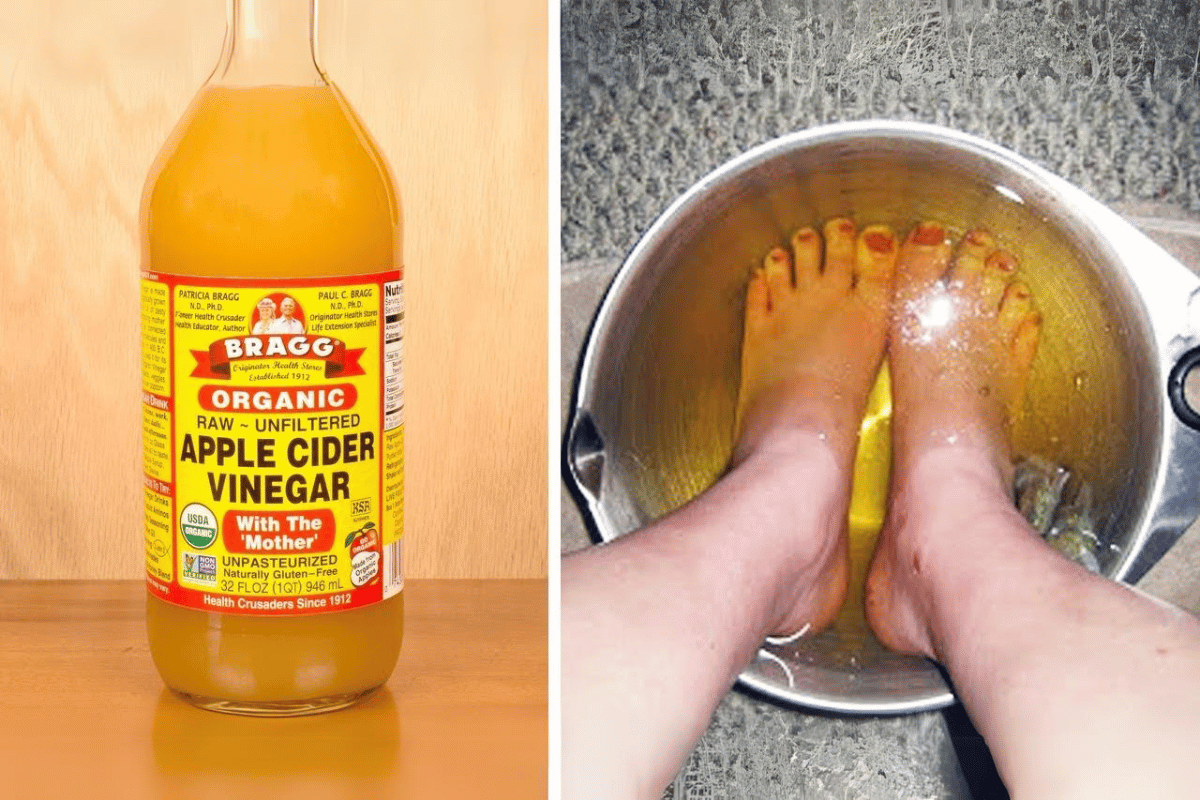 apple cider vinegar on feet weight loss