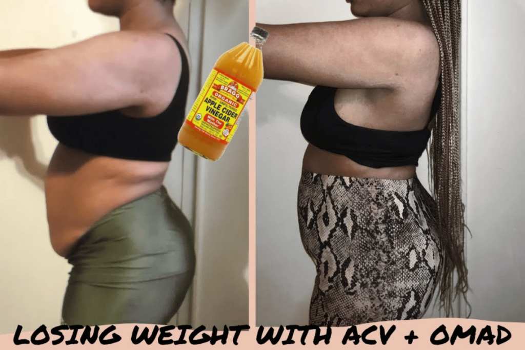 can apple cider vinegar burn belly fat