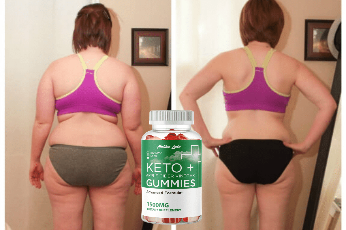 can you lose weight with apple cider vinegar