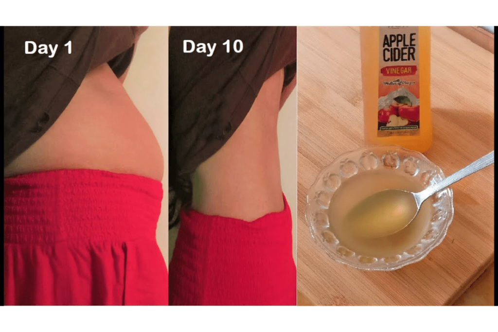 apple cider vinegar and baking soda to lose weight