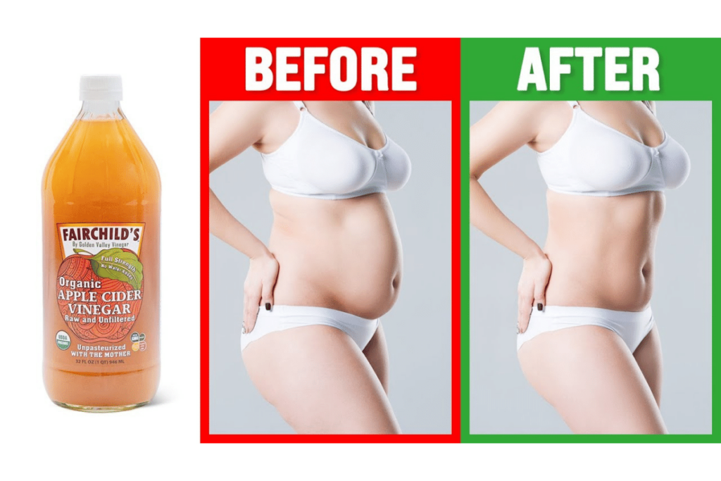 will apple cider vinegar burn fat
