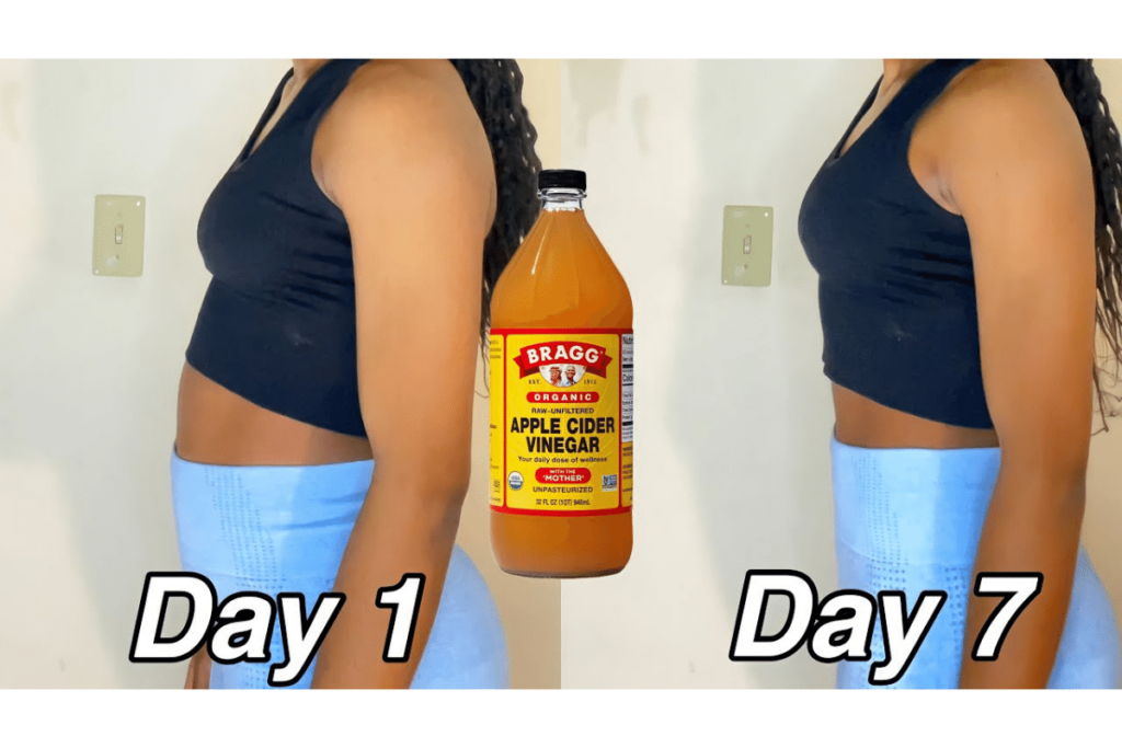 does apple vinegar burn fat