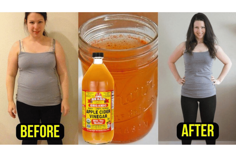 apple vinegar in weight loss