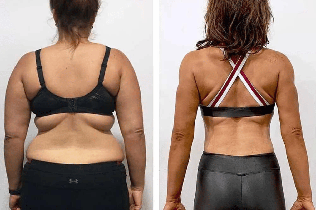 best way to lose stomach fat fast