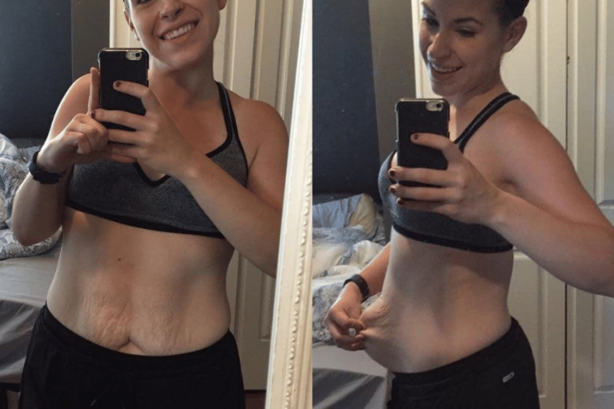 fastest way to lose weight without working out