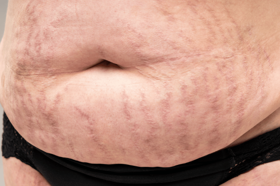 get rid of menopausal belly fat