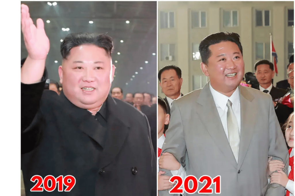 kim jong un weight loss