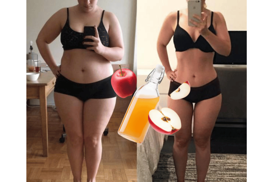losing weight on apple cider vinegar