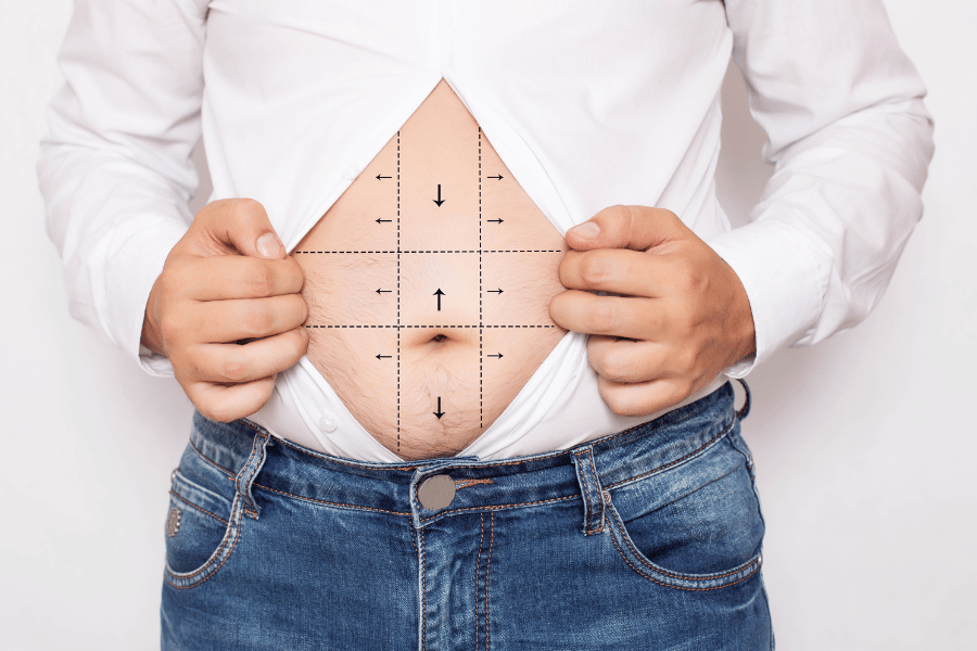 remove belly fat without surgery