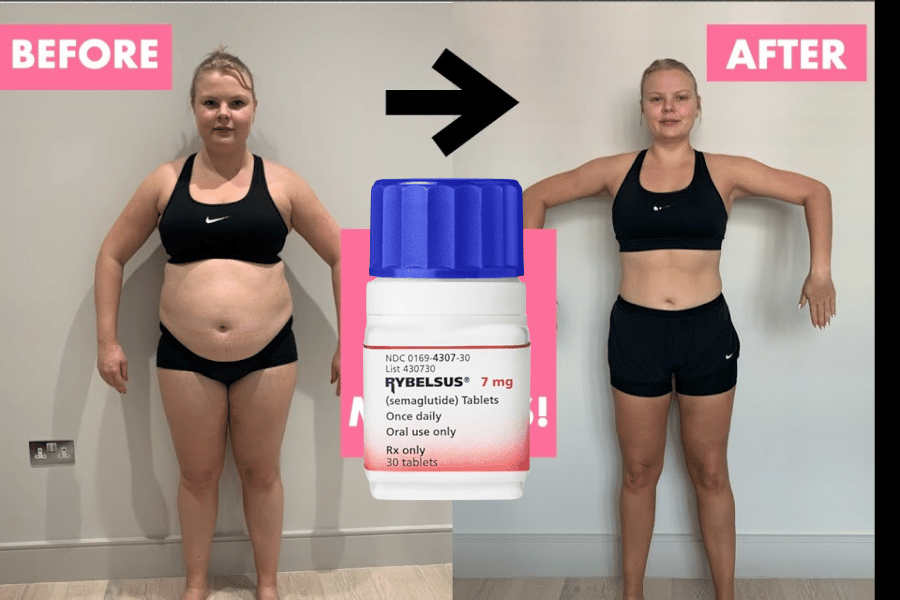semaglutide weight loss results Semaglutide Pills Effortless Weight Loss: 15-Pound Success in 35 Days for  Abdominal Obesity [baKOYv]