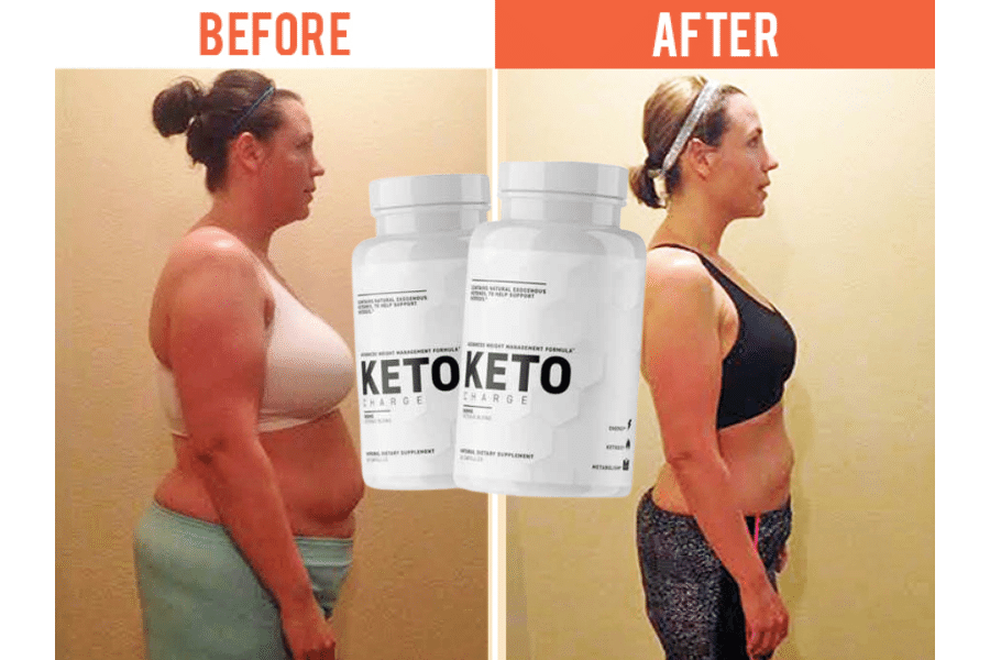 wellbutrin weight loss