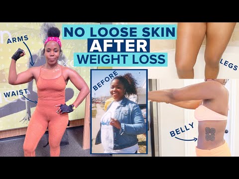 biolyfe keto gummies