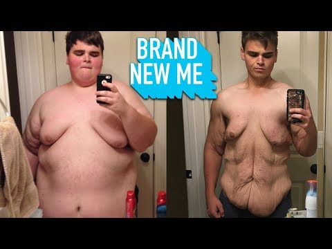 best keto gummies for weight loss