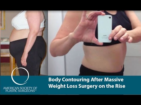 weight loss success story blog