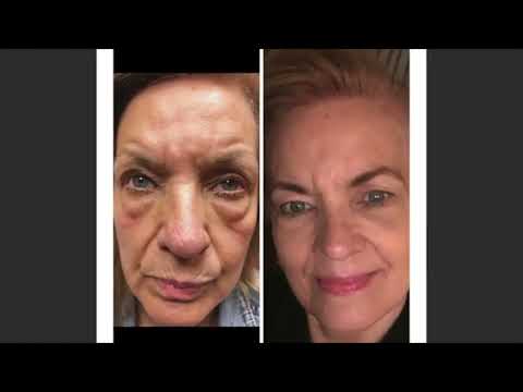 gabourey sidibe weight loss